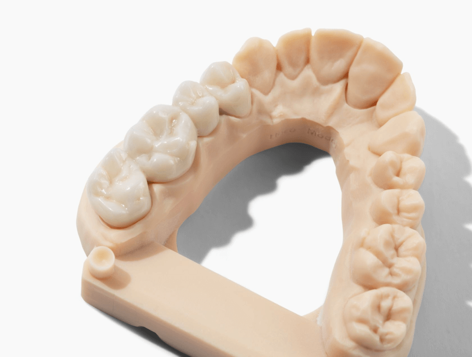Crown & bridge lab products